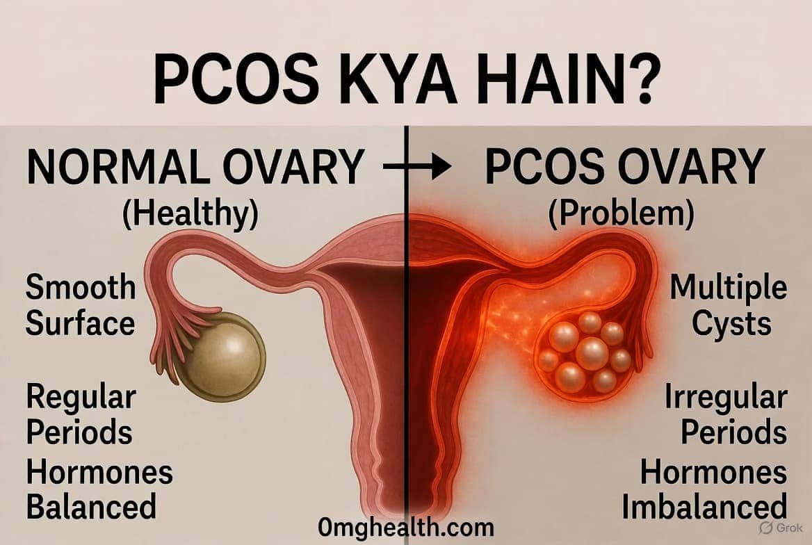 PCOS symptoms in women including irregular periods, weight gain, acne and facial hair illustration